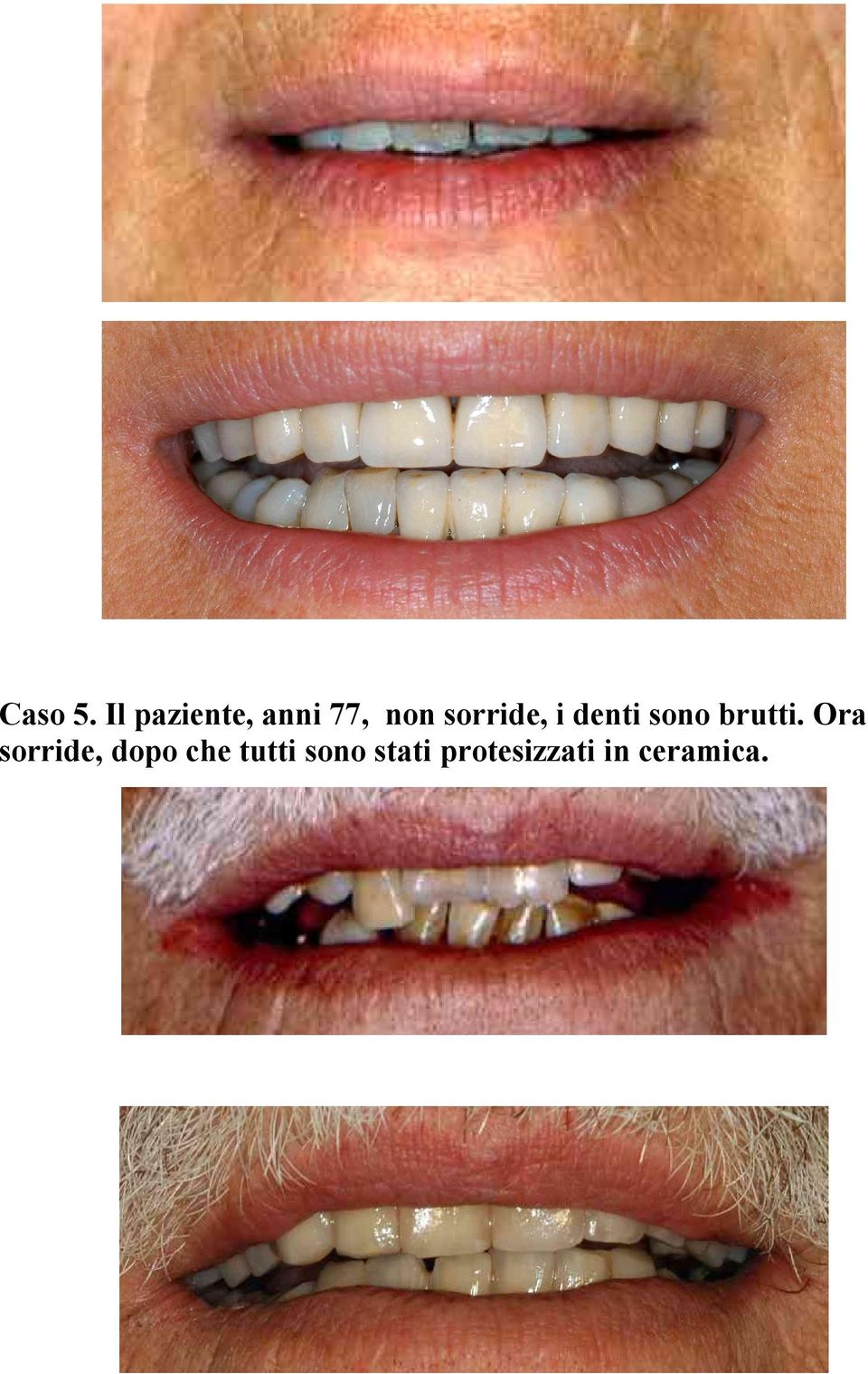 sorride, i denti sono brutti.