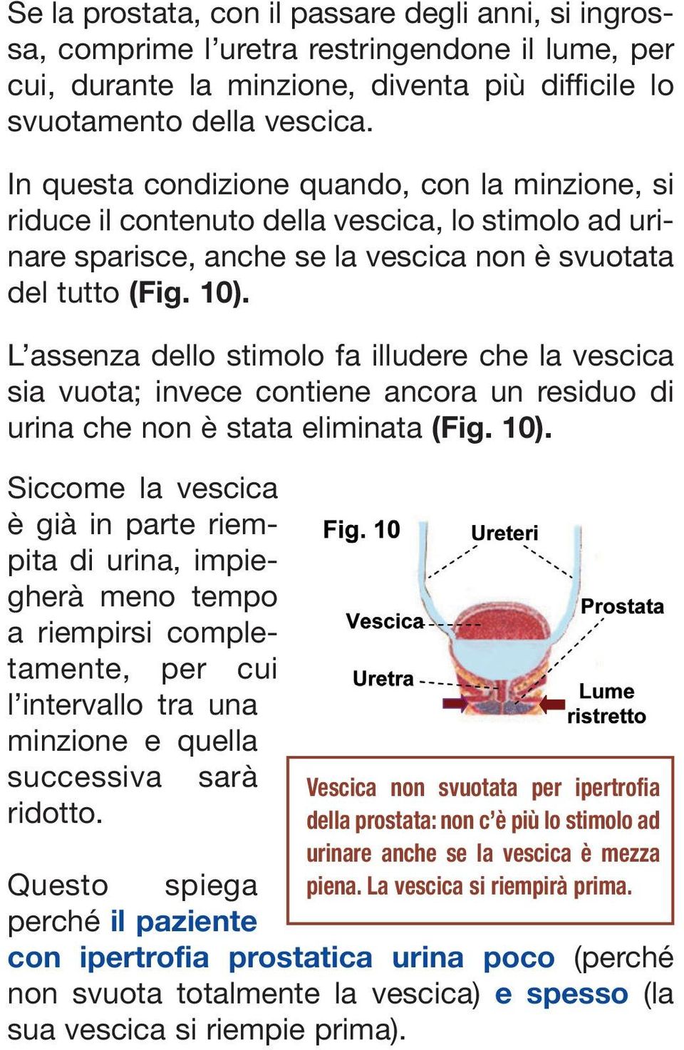 L assenza dello stimolo fa illudere che la vescica sia vuota; invece contiene ancora un residuo di urina che non è stata eliminata (Fig. 10).