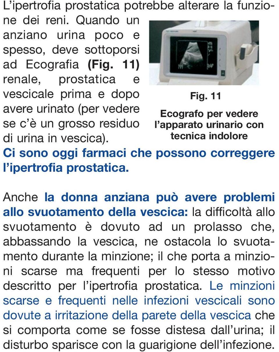 11 Ecografo per vedere l apparato urinario con tecnica indolore Ci sono oggi farmaci che possono correggere l ipertrofia prostatica.
