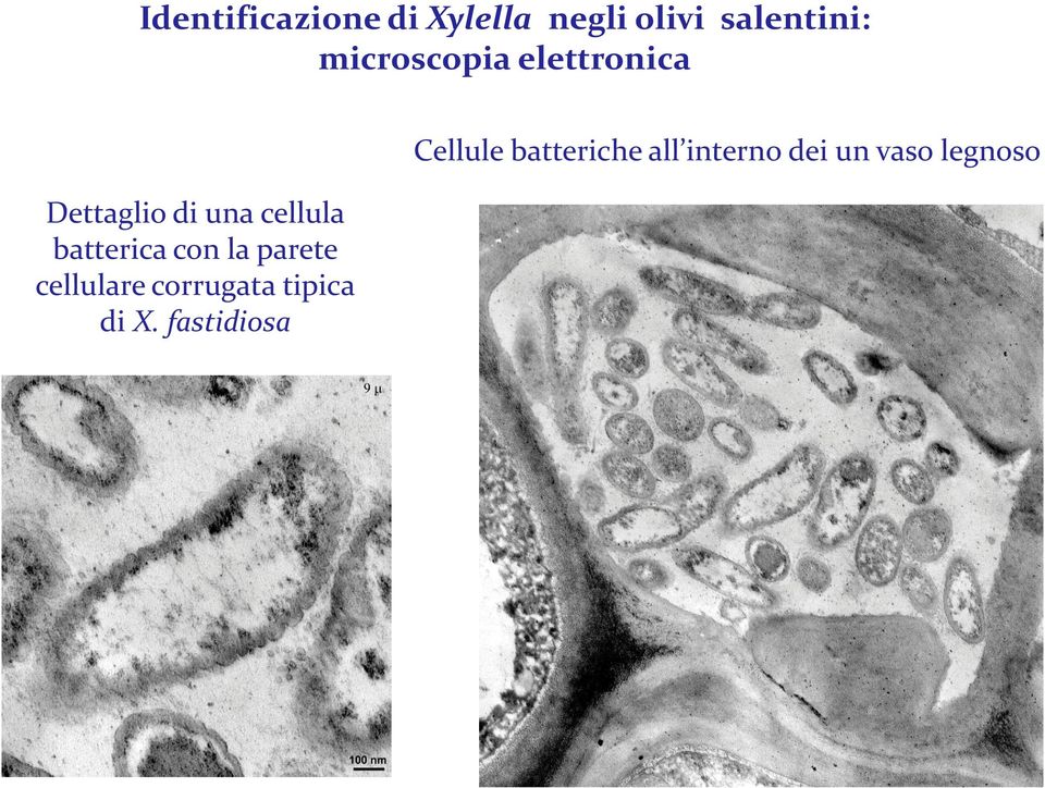 batterica con la parete cellulare corrugata tipica di