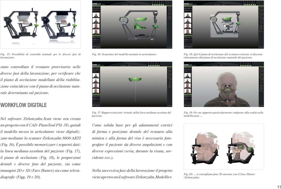 WORKFLOW DIGITALE Nel software Zirkonzahn.Scan viene ora creato il modello messo in articolatore viene digitaliz- (Fig. 16).