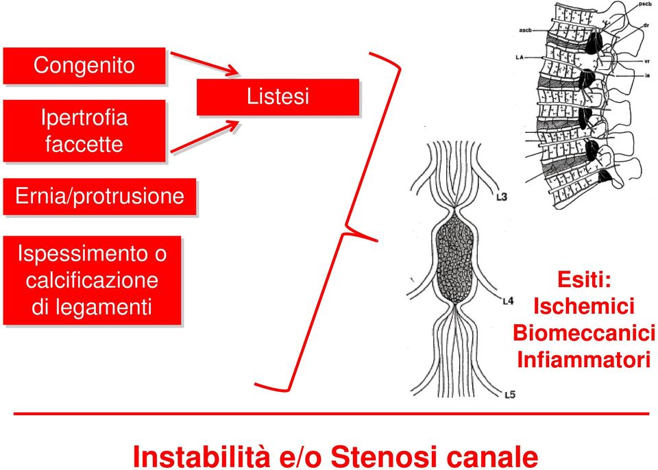 calcificazione di legamenti Esiti: