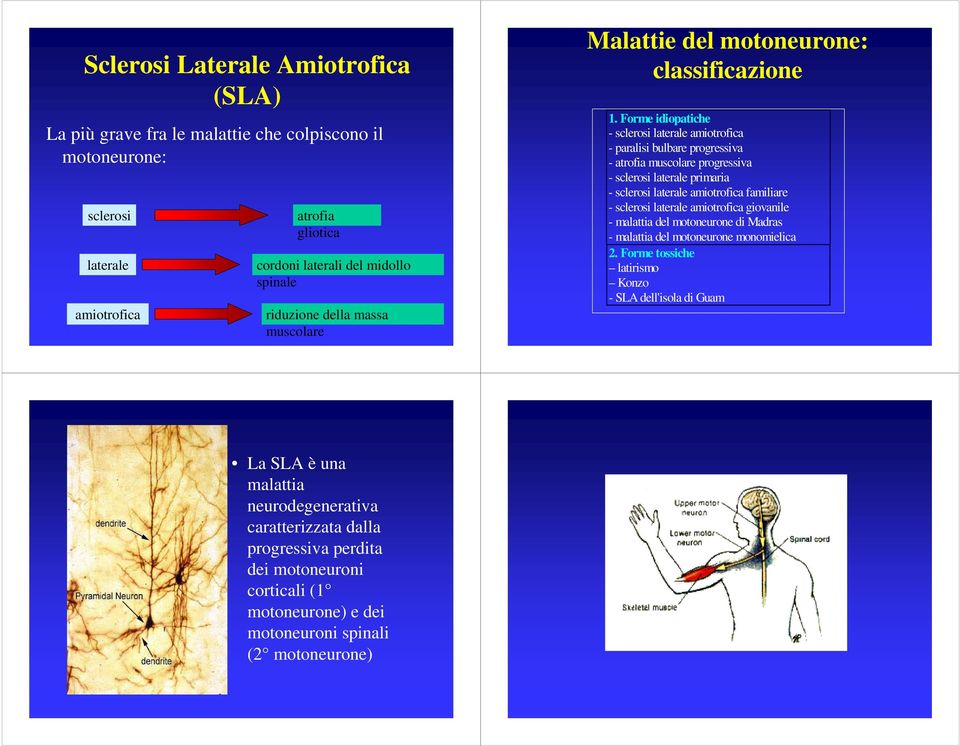 Forme idiopatiche - sclerosi laterale amiotrofica - paralisi bulbare progressiva - atrofia muscolare progressiva - sclerosi laterale primaria - sclerosi laterale amiotrofica familiare - sclerosi