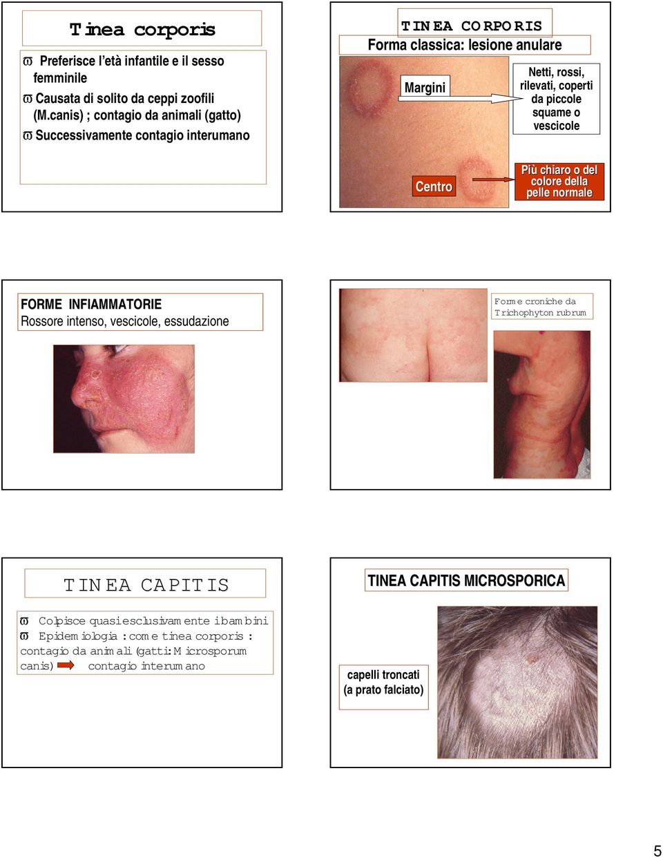 piccole squame o vescicole Centro Più chiaro o del colore della pelle normale FORME INFIAMMATORIE Rossore intenso, vescicole, essudazione Forme croniche da