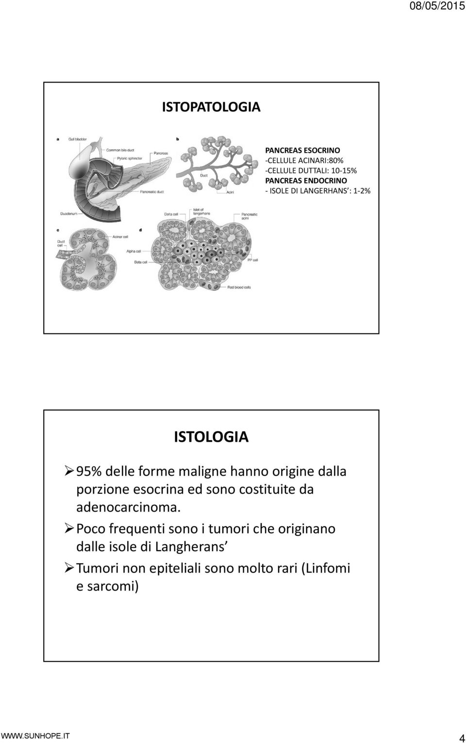 dalla porzione esocrina ed sono costituite da adenocarcinoma.