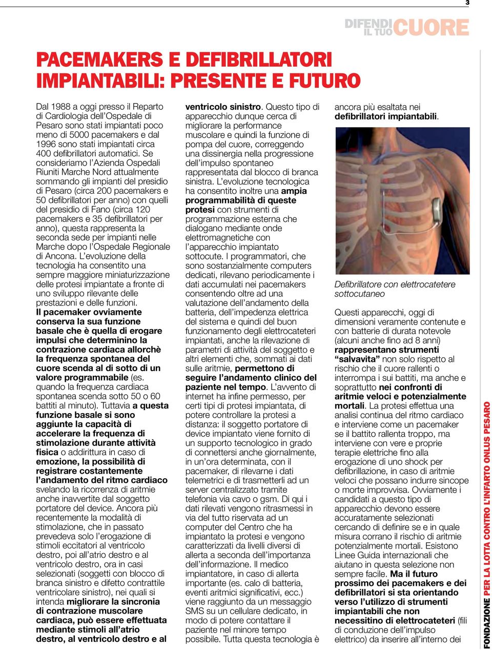 Se consideriamo l Azienda Ospedali Riuniti Marche Nord attualmente sommando gli impianti del presidio di Pesaro (circa 200 pacemakers e 50 defibrillatori per anno) con quelli del presidio di Fano
