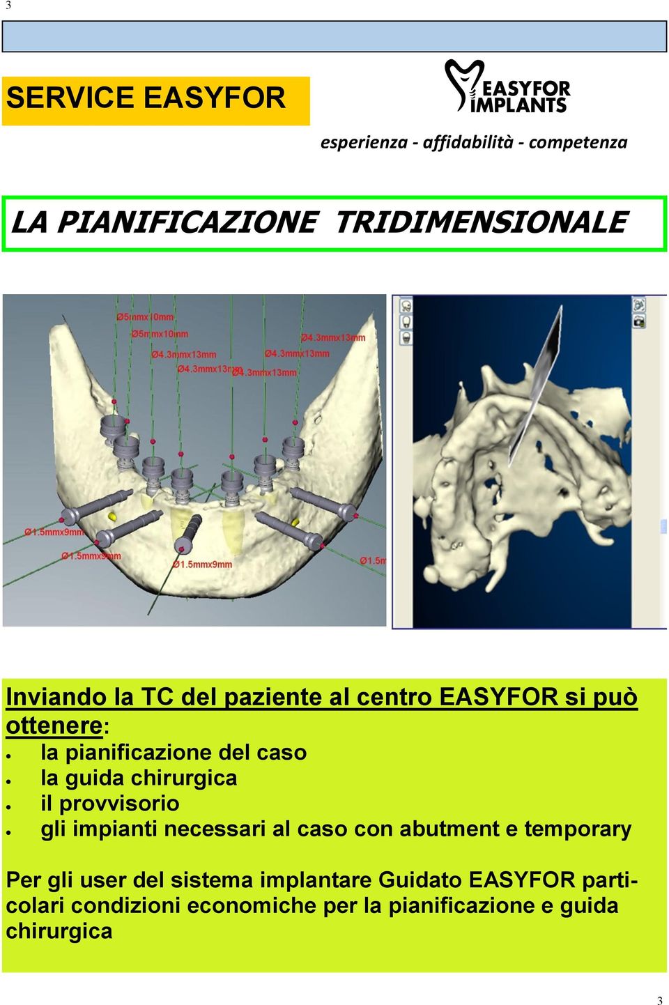 impianti necessari al caso con abutment e temporary Per gli user del sistema implantare