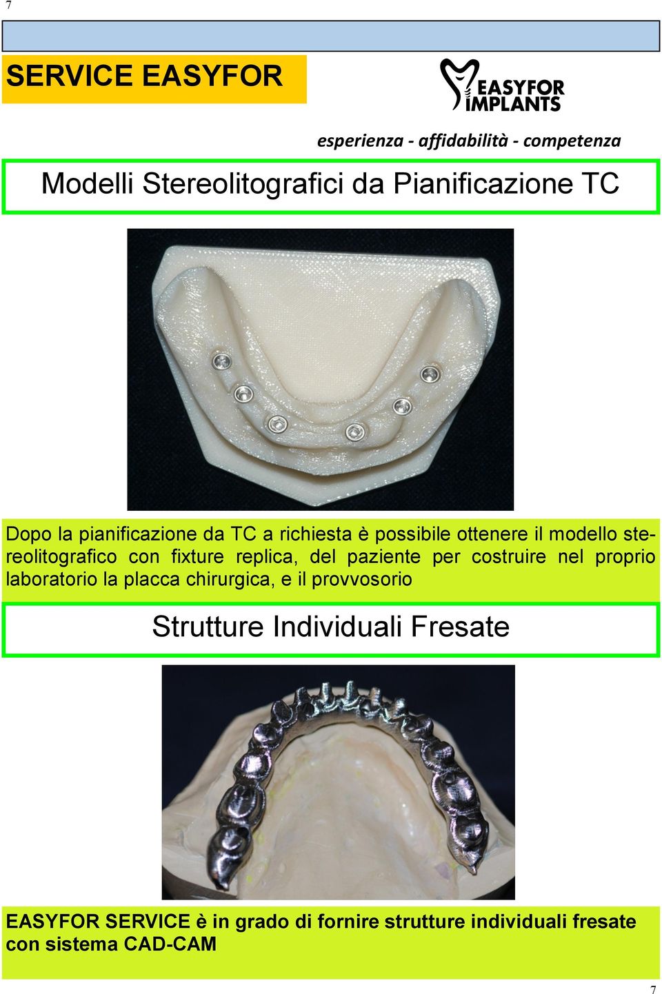 per costruire nel proprio laboratorio la placca chirurgica, e il provvosorio Strutture