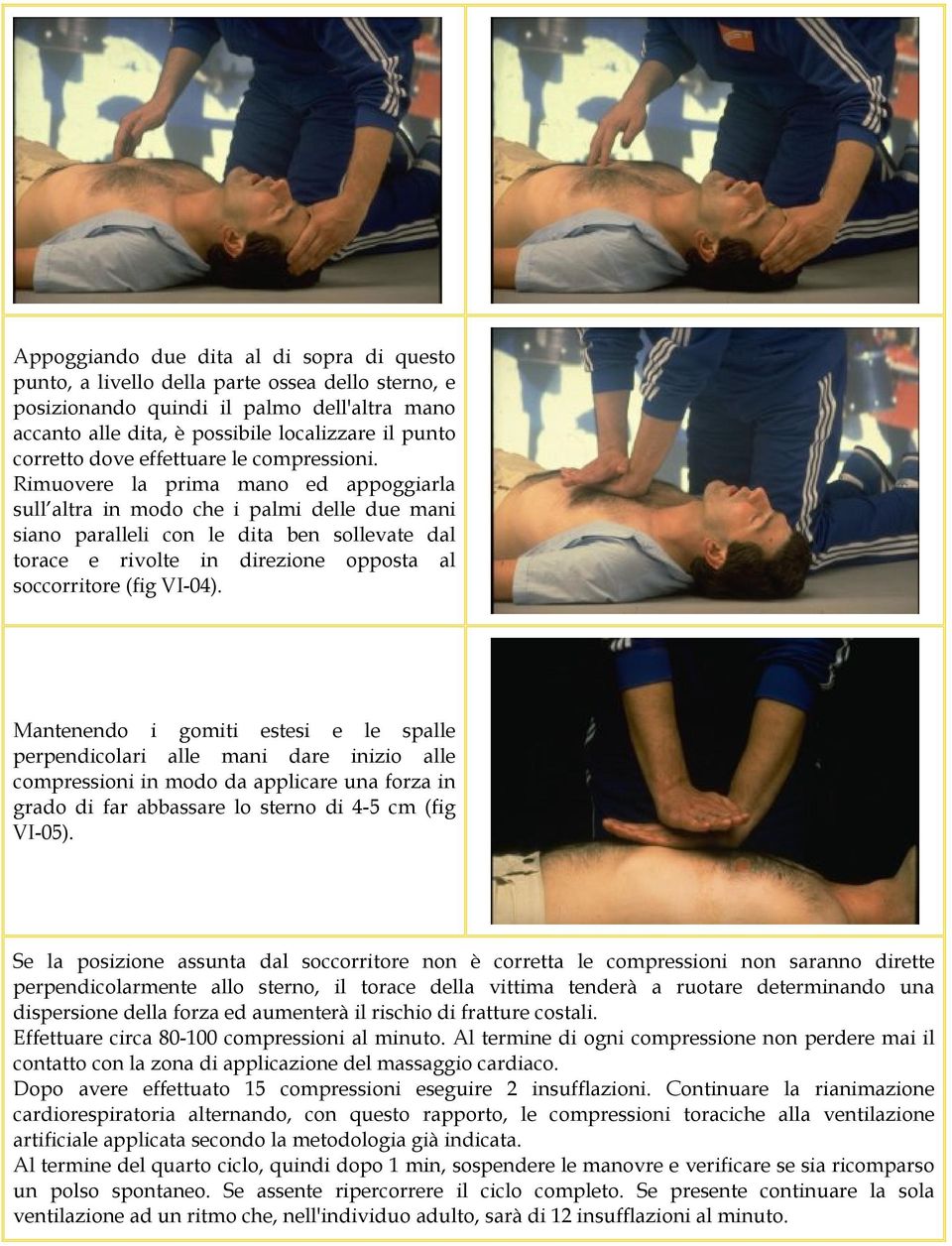 Rimuovere la prima mano ed appoggiarla sull altra in modo che i palmi delle due mani siano paralleli con le dita ben sollevate dal torace e rivolte in direzione opposta al soccorritore (fig VI-04).