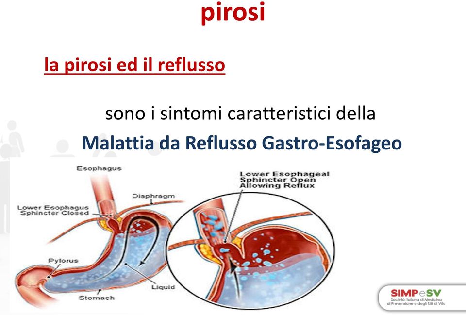 caratteristici della