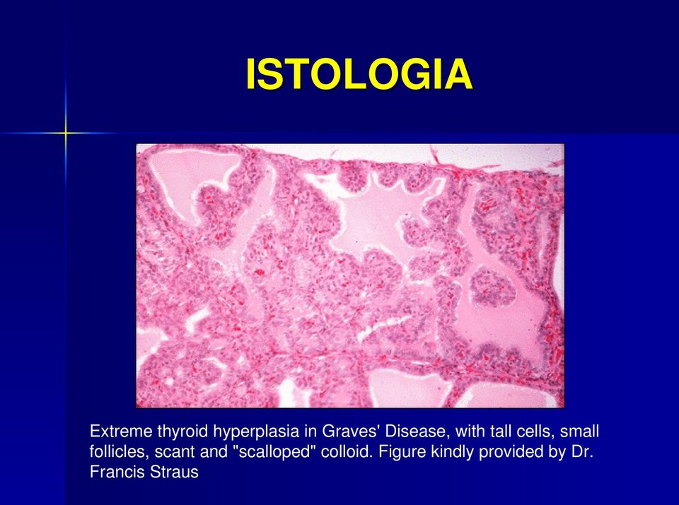 follicles, scant and "scalloped" colloid.