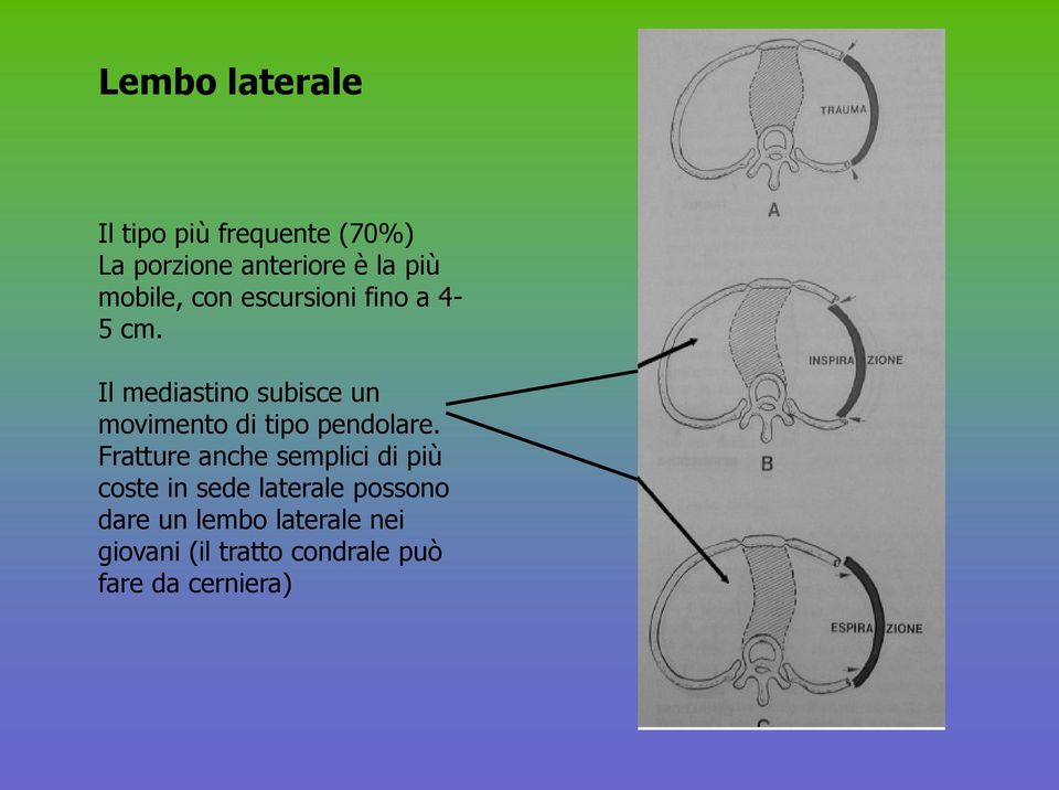 Il mediastino subisce un movimento di tipo pendolare.