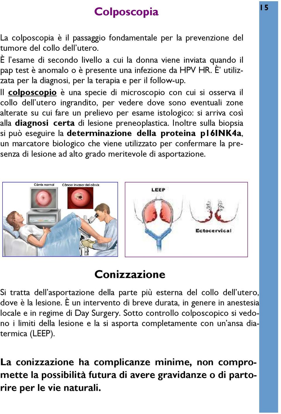 Il colposcopio è una specie di microscopio con cui si osserva il collo dell utero ingrandito, per vedere dove sono eventuali zone alterate su cui fare un prelievo per esame istologico: si arriva così