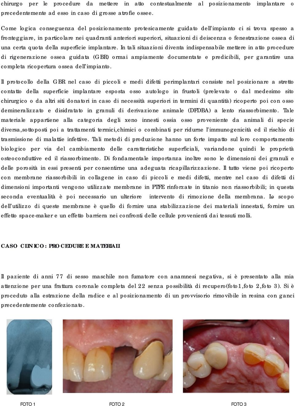 fenestrazione ossea di una certa quota della superficie implantare.