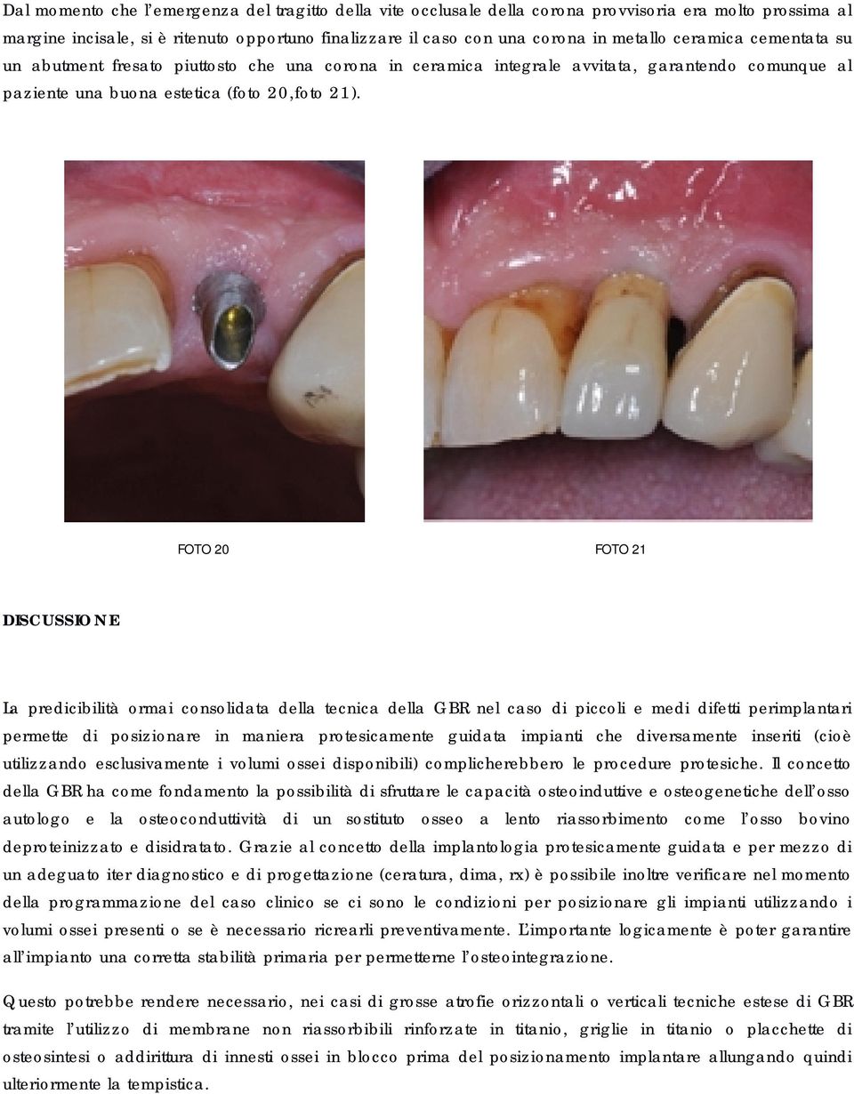 FOTO 20 FOTO 21 DISCUSSIONE La predicibilità ormai consolidata della tecnica della GBR nel caso di piccoli e medi difetti perimplantari permette di posizionare in maniera protesicamente guidata