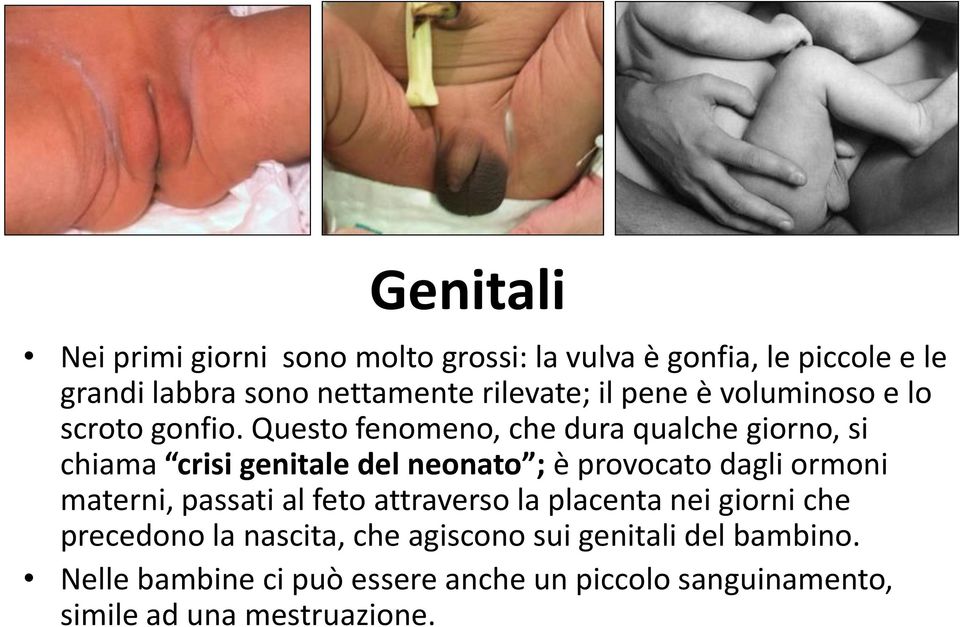 Questo fenomeno, che dura qualche giorno, si chiama crisi genitale del neonato ; è provocato dagli ormoni materni,