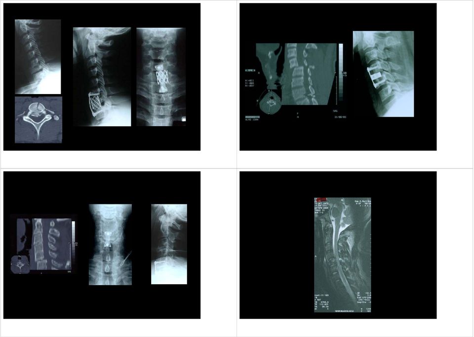 Cervicale