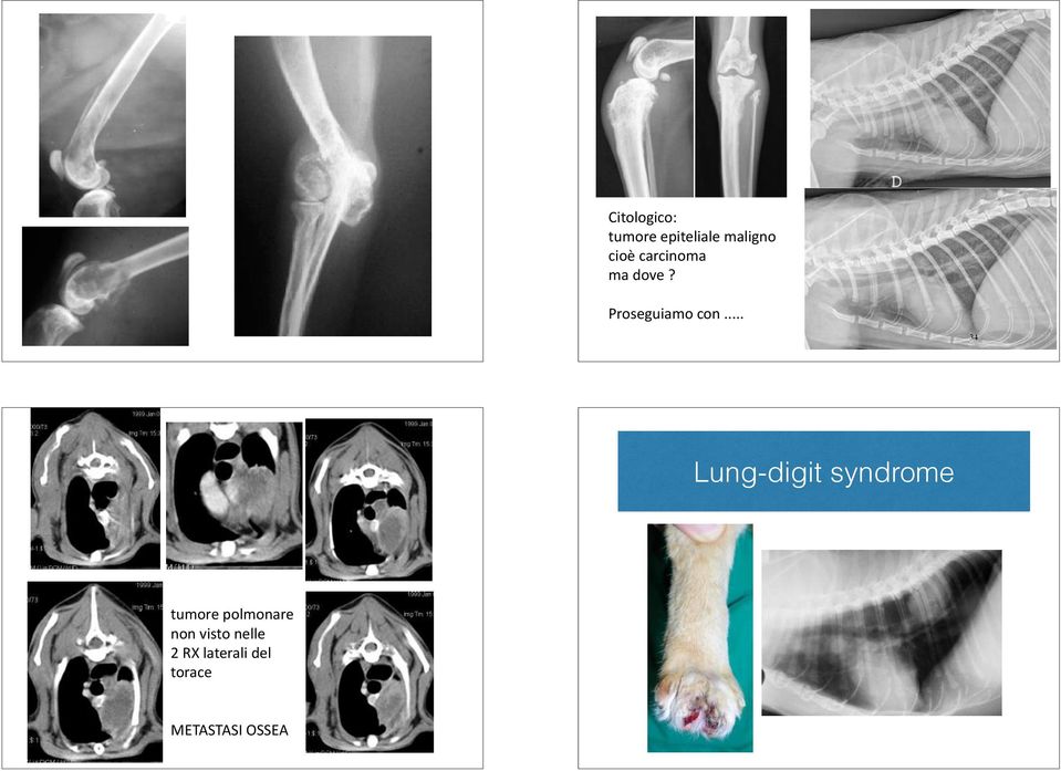 .. 34 Lung-digit syndrome tumore polmonare