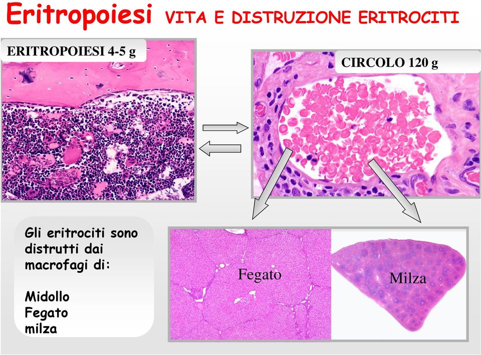 eritrociti sono distrutti dai macrofagi