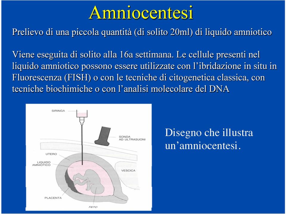 Le cellule presenti nel liquido amniotico possono essere utilizzate con l ibridazione in situ in