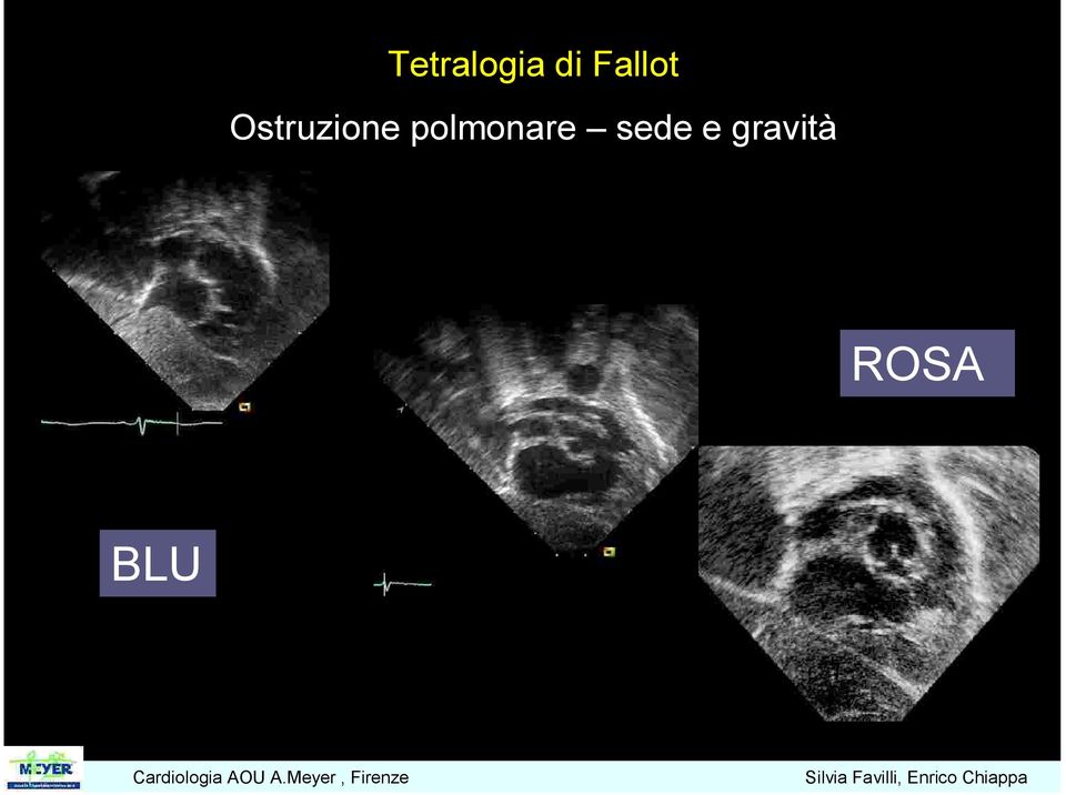 Ostruzione