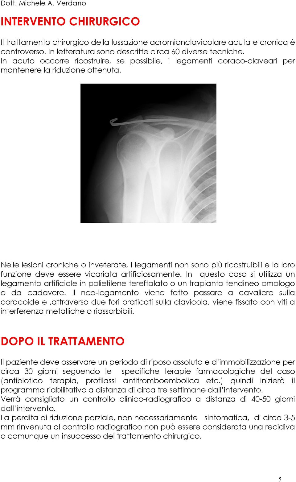 Nelle lesioni croniche o inveterate, i legamenti non sono più ricostruibili e la loro funzione deve essere vicariata artificiosamente.