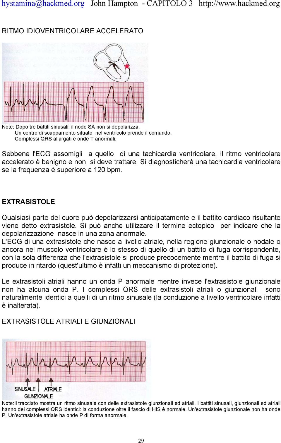 Si diagnosticherà una tachicardia ventricolare se la frequenza è superiore a 120 bpm.