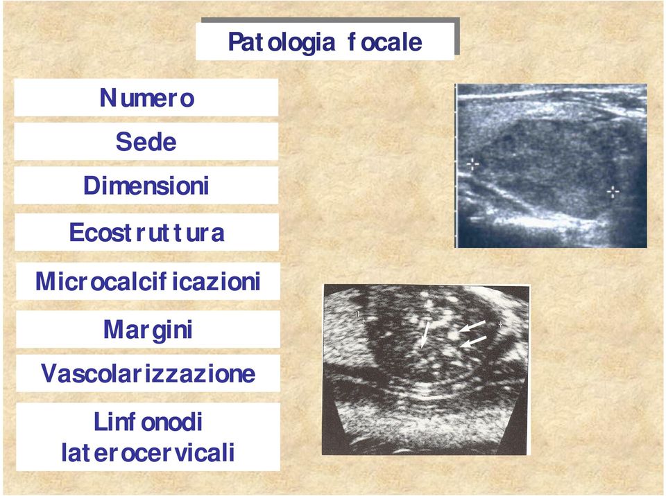 Microcalcificazioni Margini