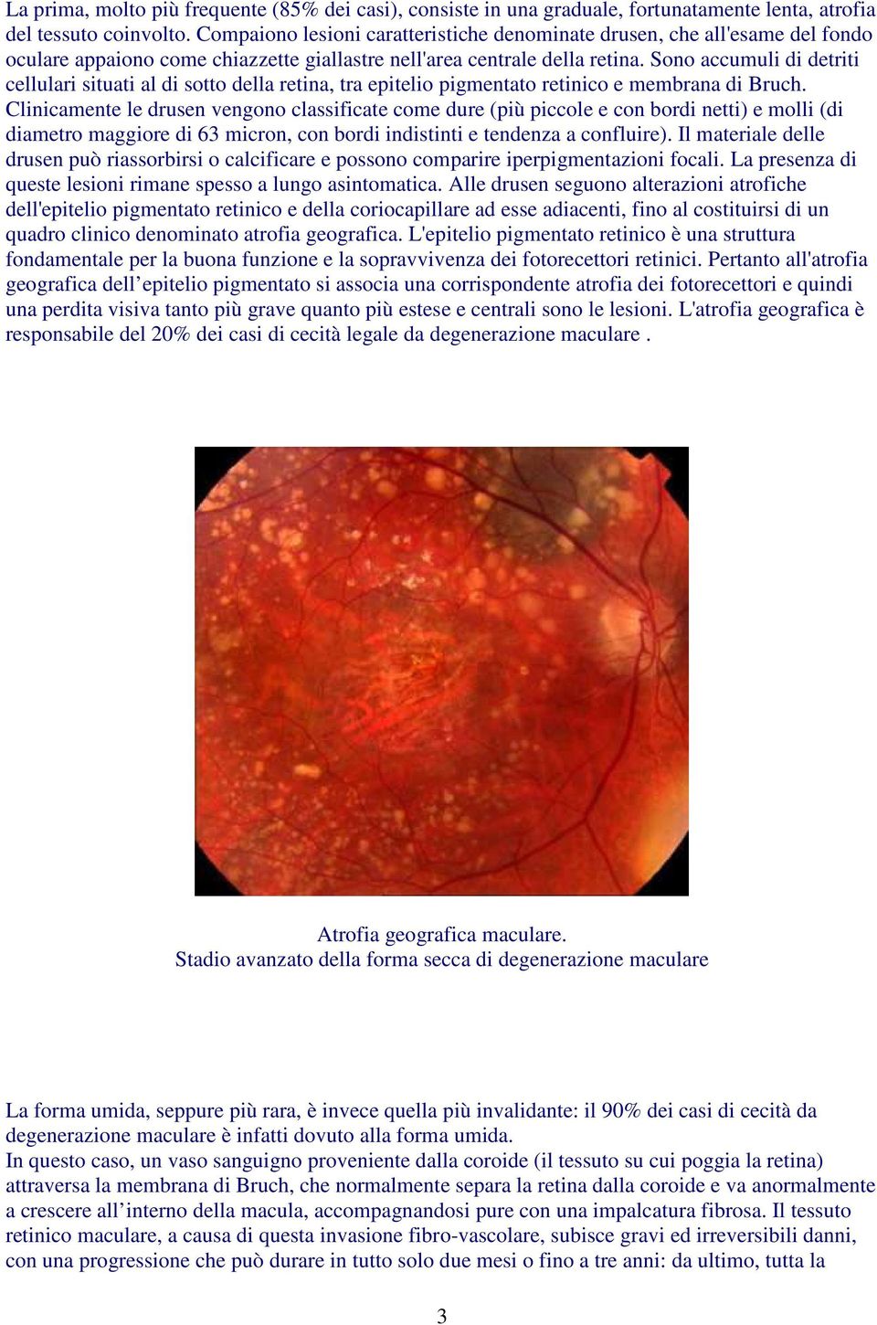 Sono accumuli di detriti cellulari situati al di sotto della retina, tra epitelio pigmentato retinico e membrana di Bruch.