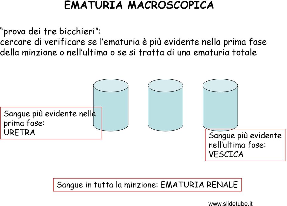 tratta di una ematuria totale Sangue più evidente nella prima fase: URETRA