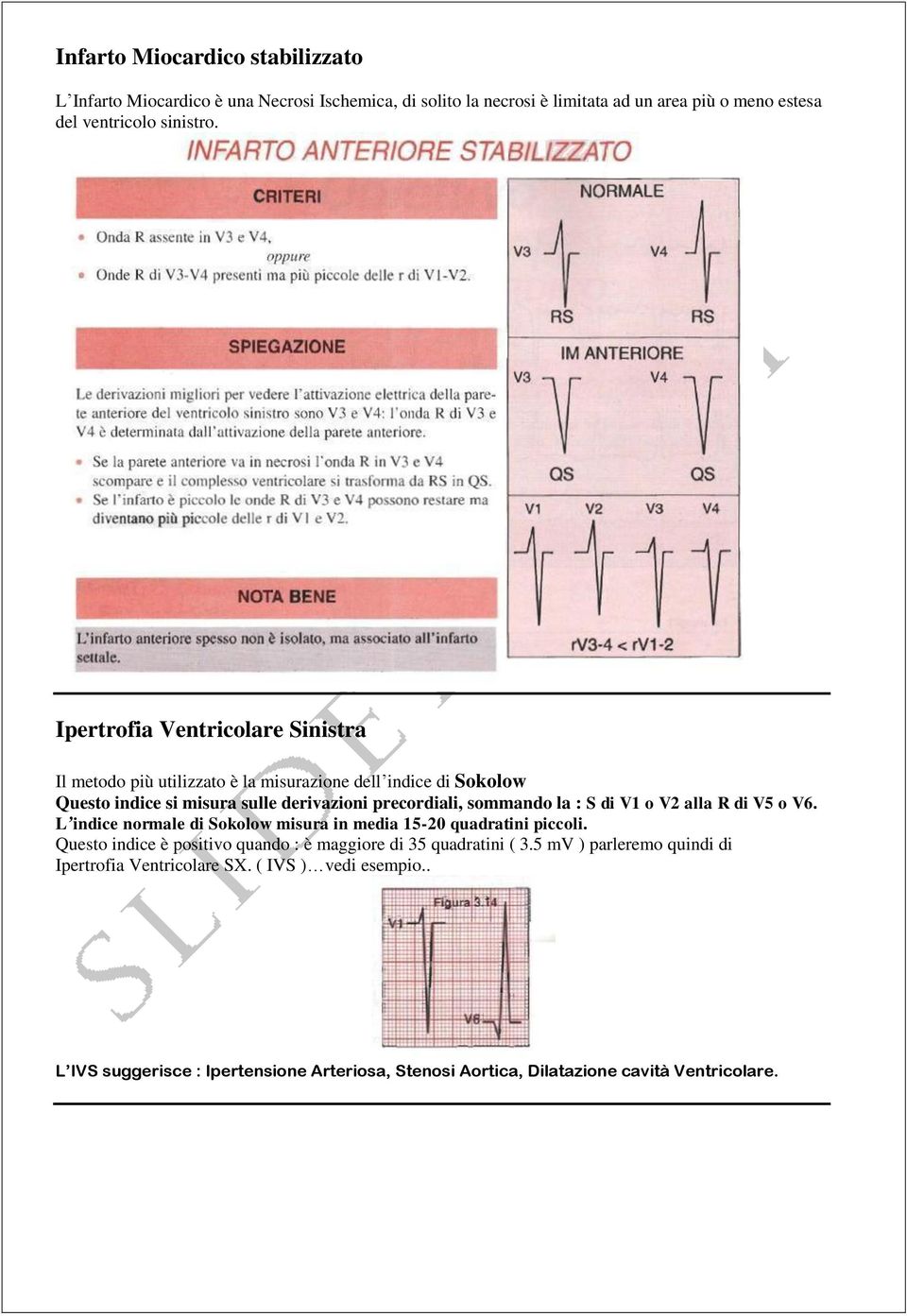 S di V1 o V2 alla R di V5 o V6. L indice normale di Sokolow misura in media 15-20 quadratini piccoli. Questo indice è positivo quando : è maggiore di 35 quadratini ( 3.