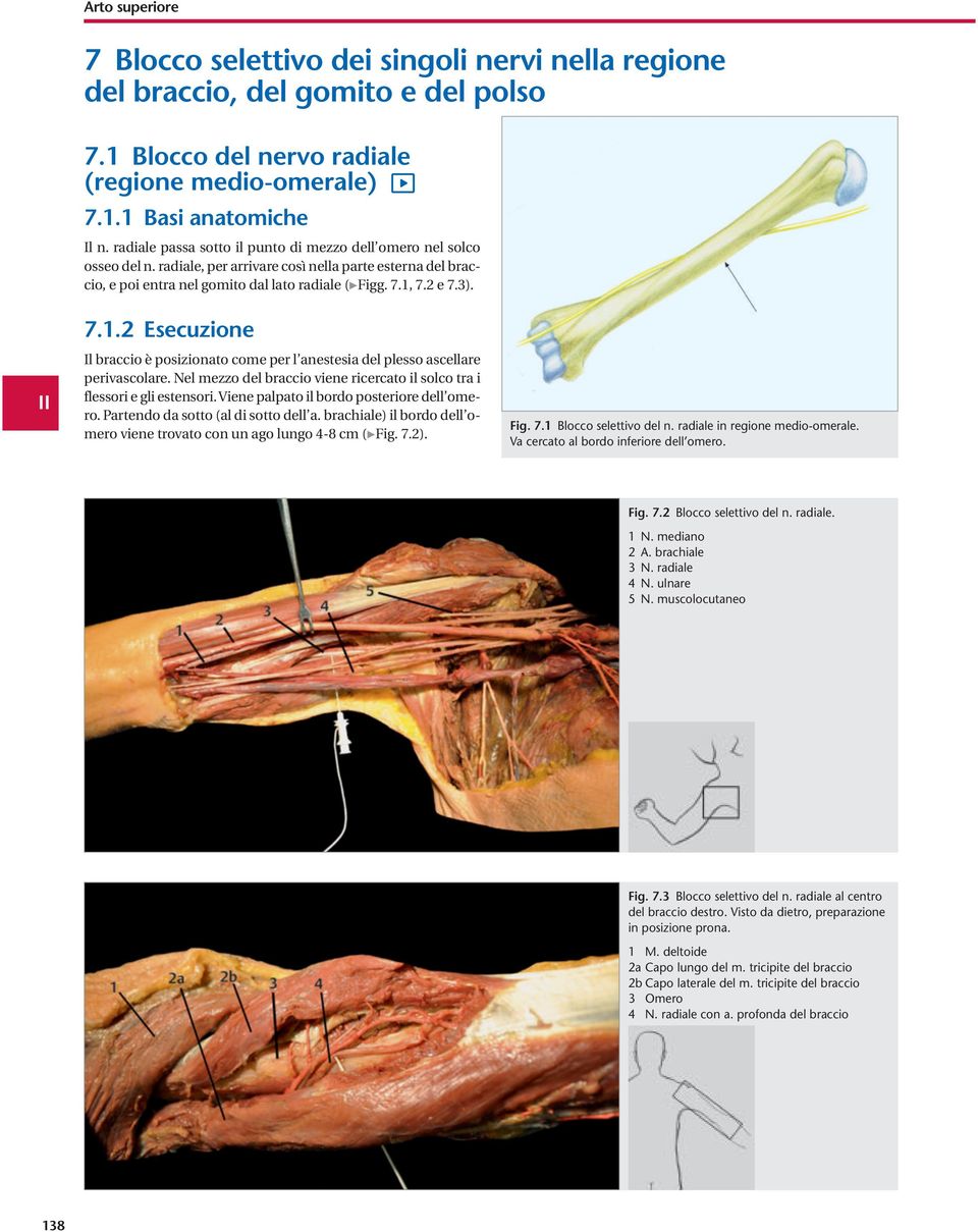 II 7.1.2 Esecuzione Il braccio è posizionato come per l anestesia del plesso ascellare perivascolare. Nel mezzo del braccio viene ricercato il solco tra i flessori e gli estensori.