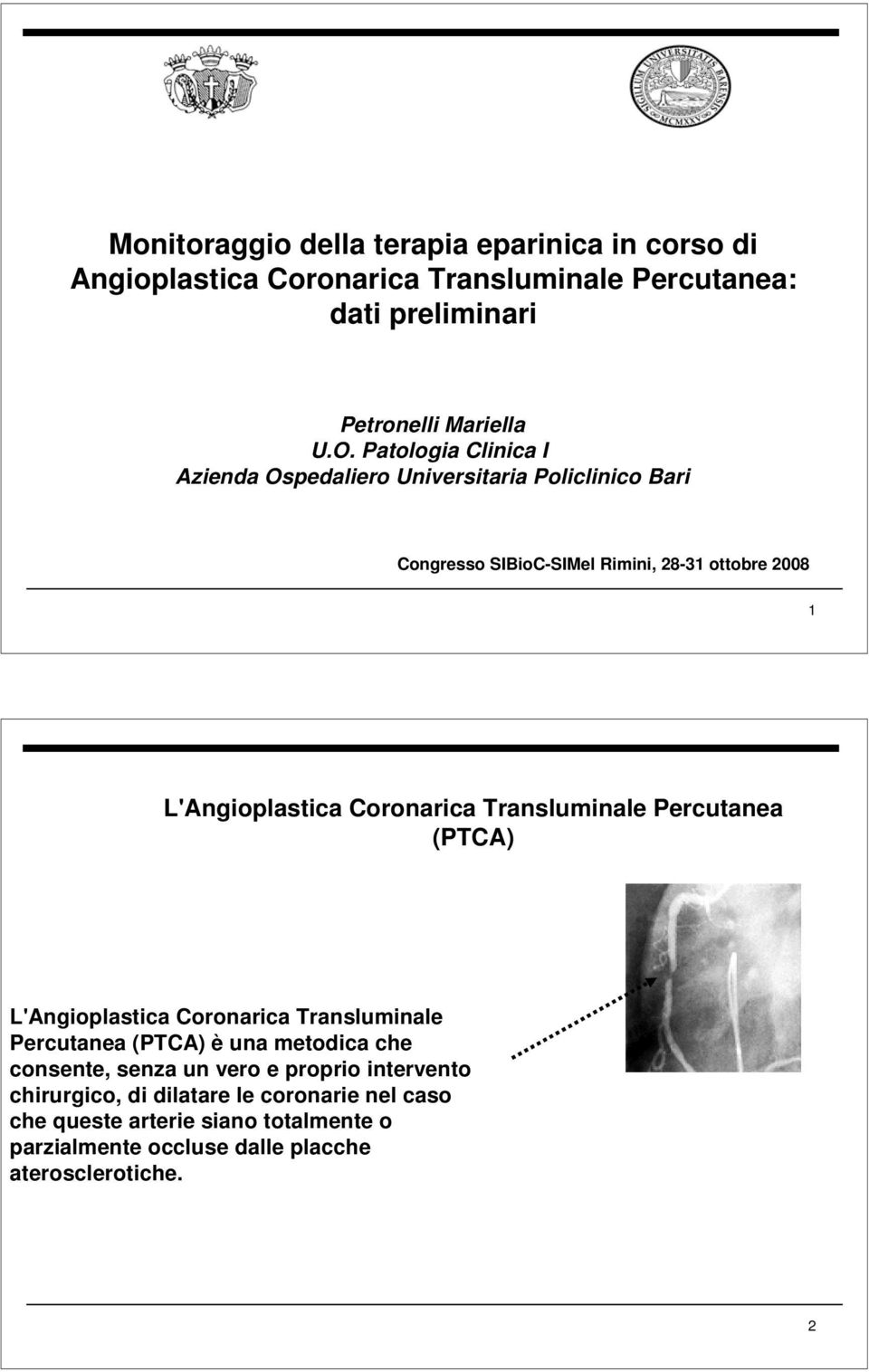Coronarica Transluminale Percutanea (PTCA) L'Angioplastica Coronarica Transluminale Percutanea (PTCA) è una metodica che consente, senza un vero e
