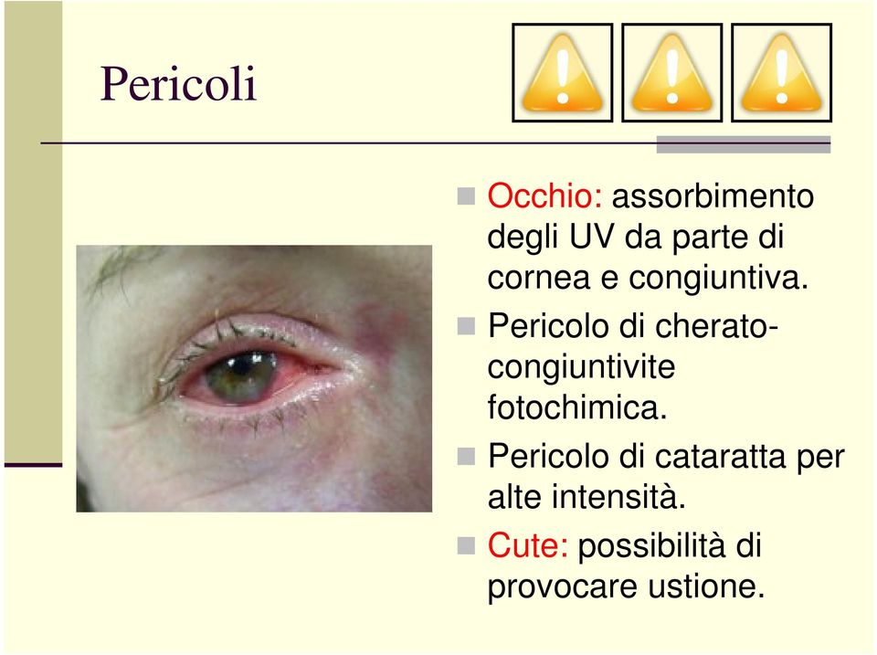 Pericolo di cheratocongiuntivite fotochimica.