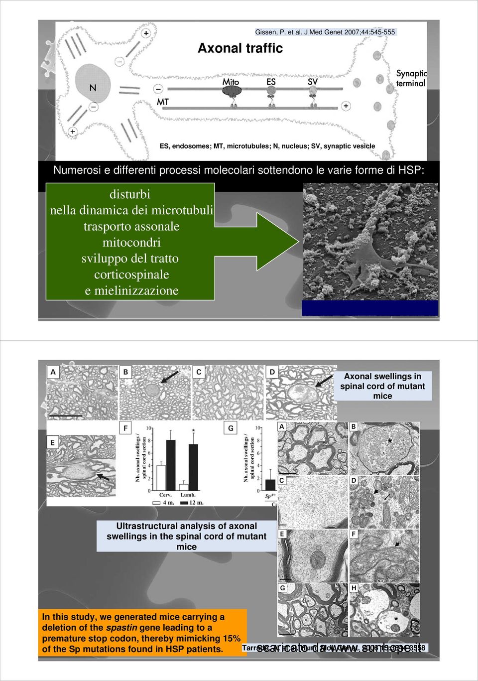 disturbi nella dinamica dei microtubuli trasporto assonale mitocondri sviluppo del tratto corticospinale e mielinizzazione Axonal swellings in spinal cord of mutant mice