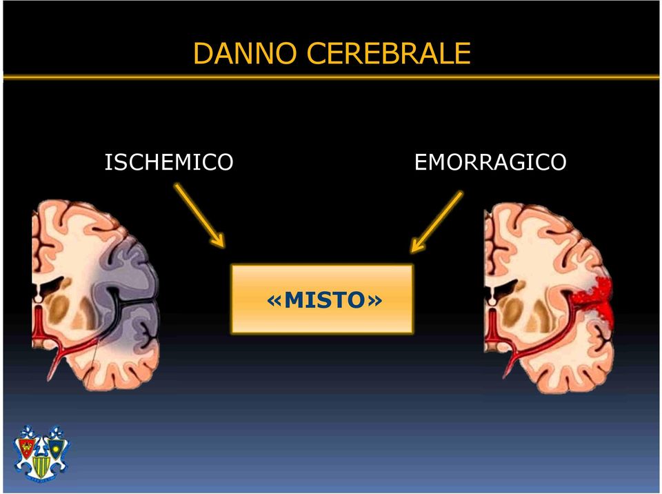 ISCHEMICO