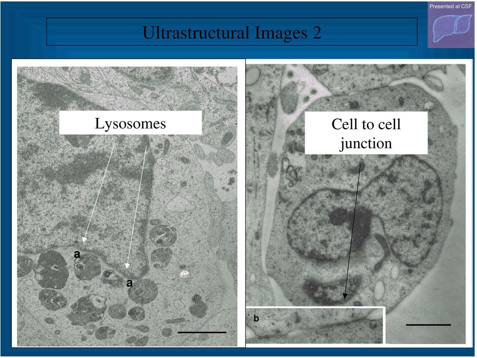 Lysosomes Cell
