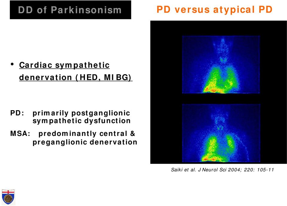 predominantly central & preganglionic denervation Early (20 min p.i.) Controls 2.