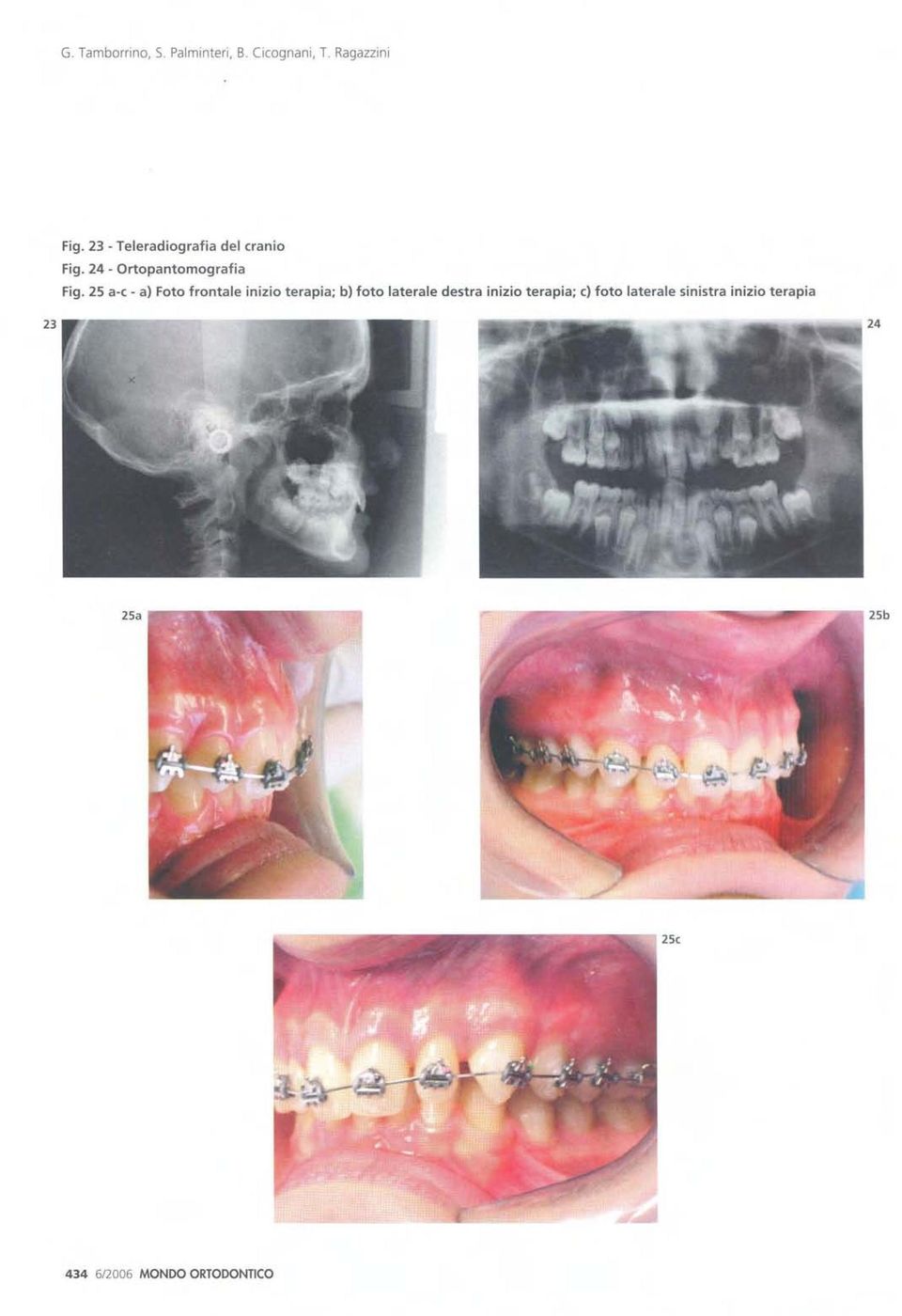 25 a-c - a) Foto frontale inizio terapia; b) foto laterale destra inizio terapia; c) foto