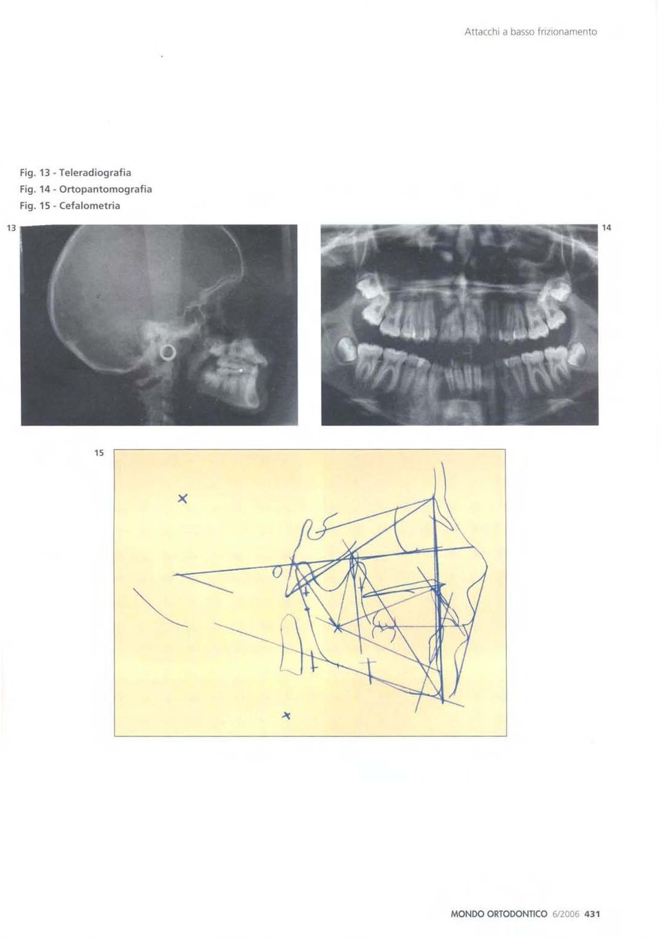 14 - Ortopantomografia Fig.