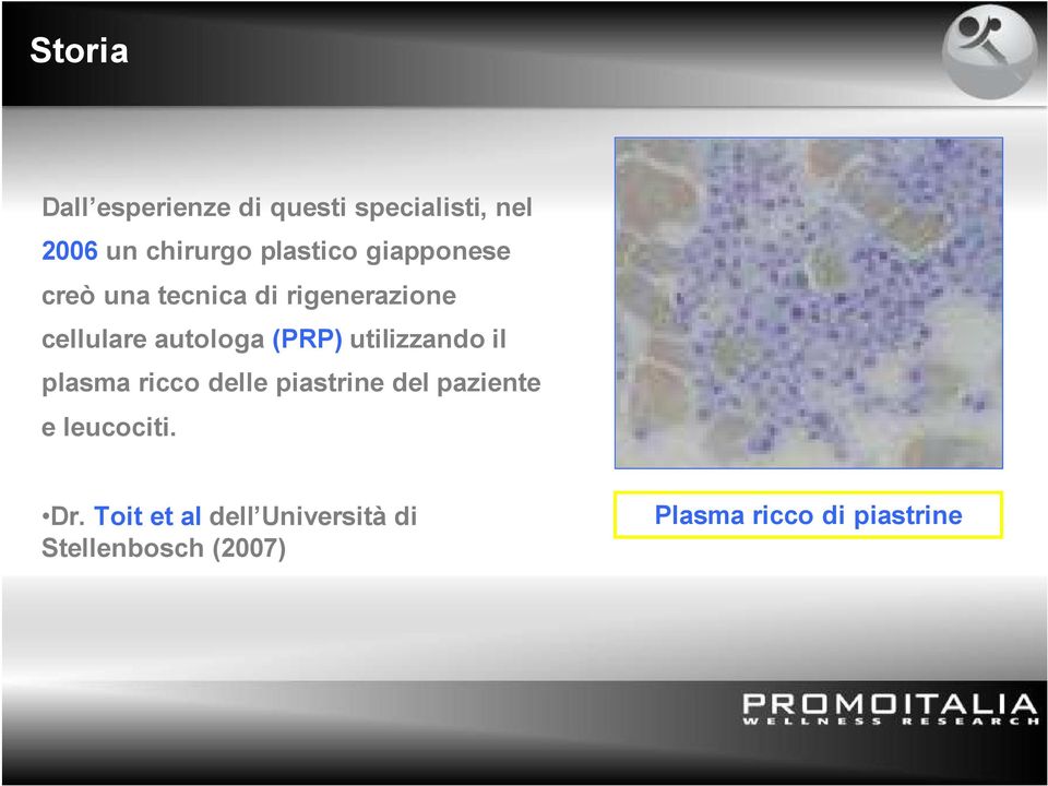 (PRP) utilizzando il plasma ricco delle piastrine del paziente e