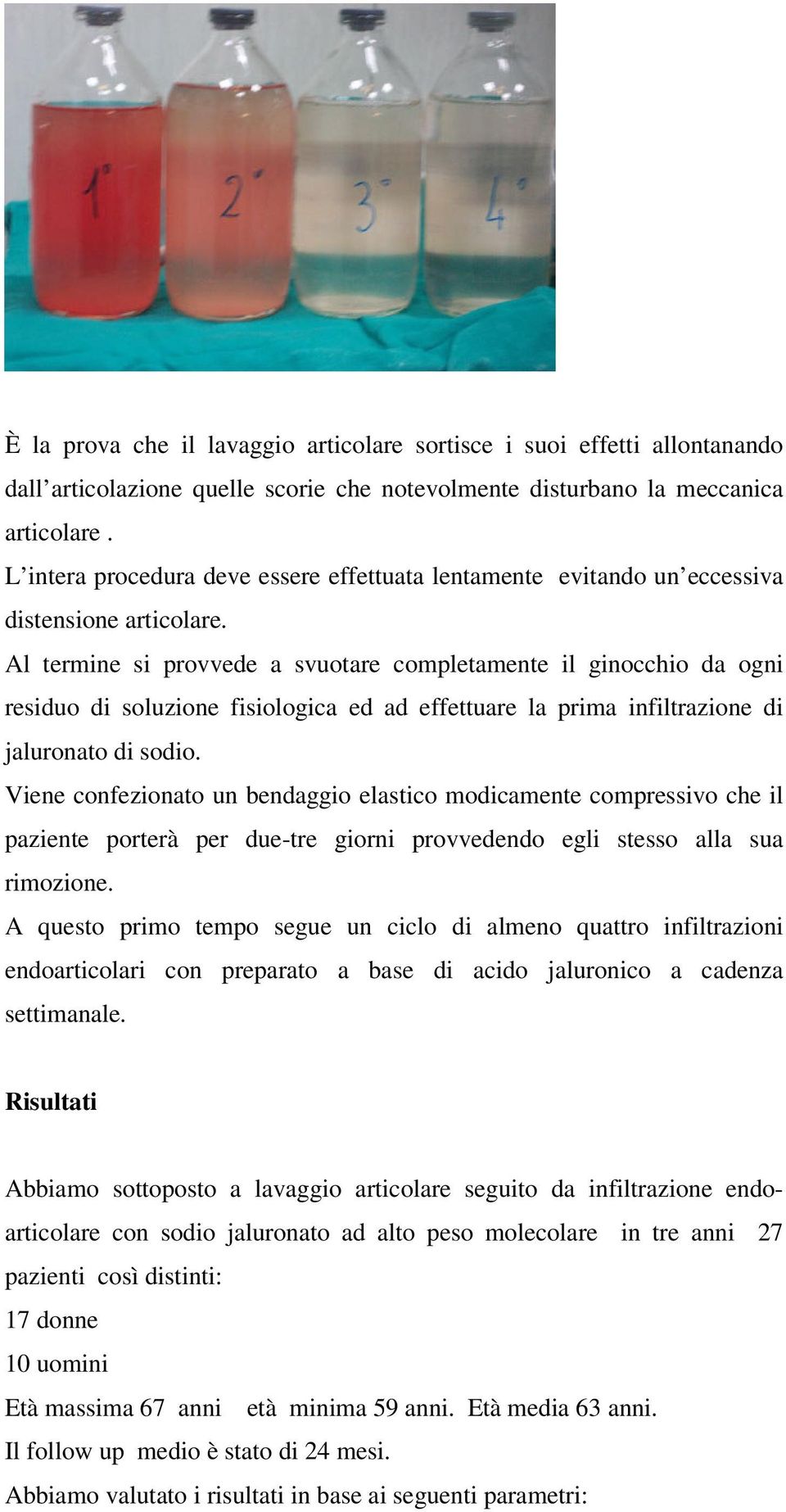 Al termine si provvede a svuotare completamente il ginocchio da ogni residuo di soluzione fisiologica ed ad effettuare la prima infiltrazione di jaluronato di sodio.