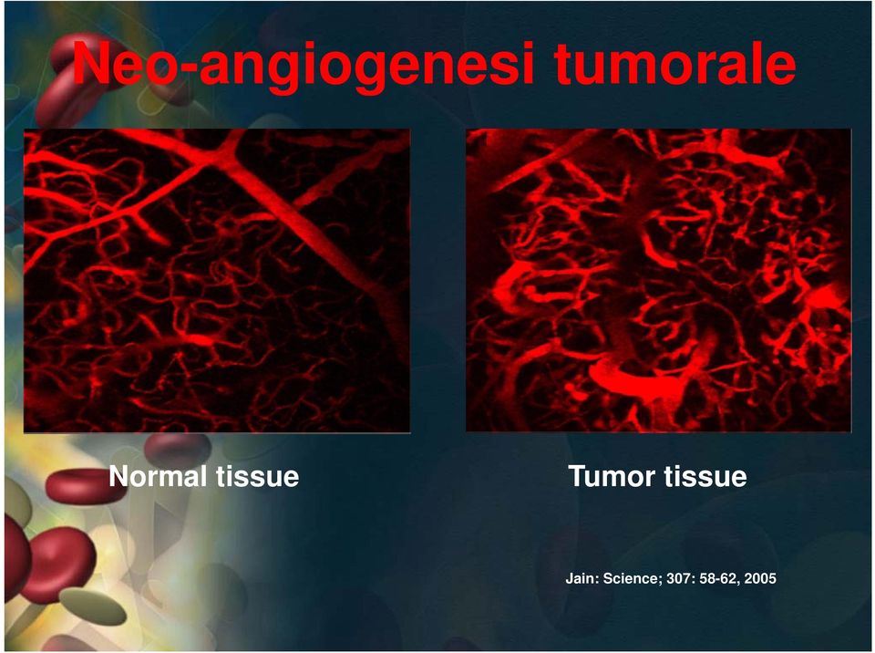 tissue Tumor tissue