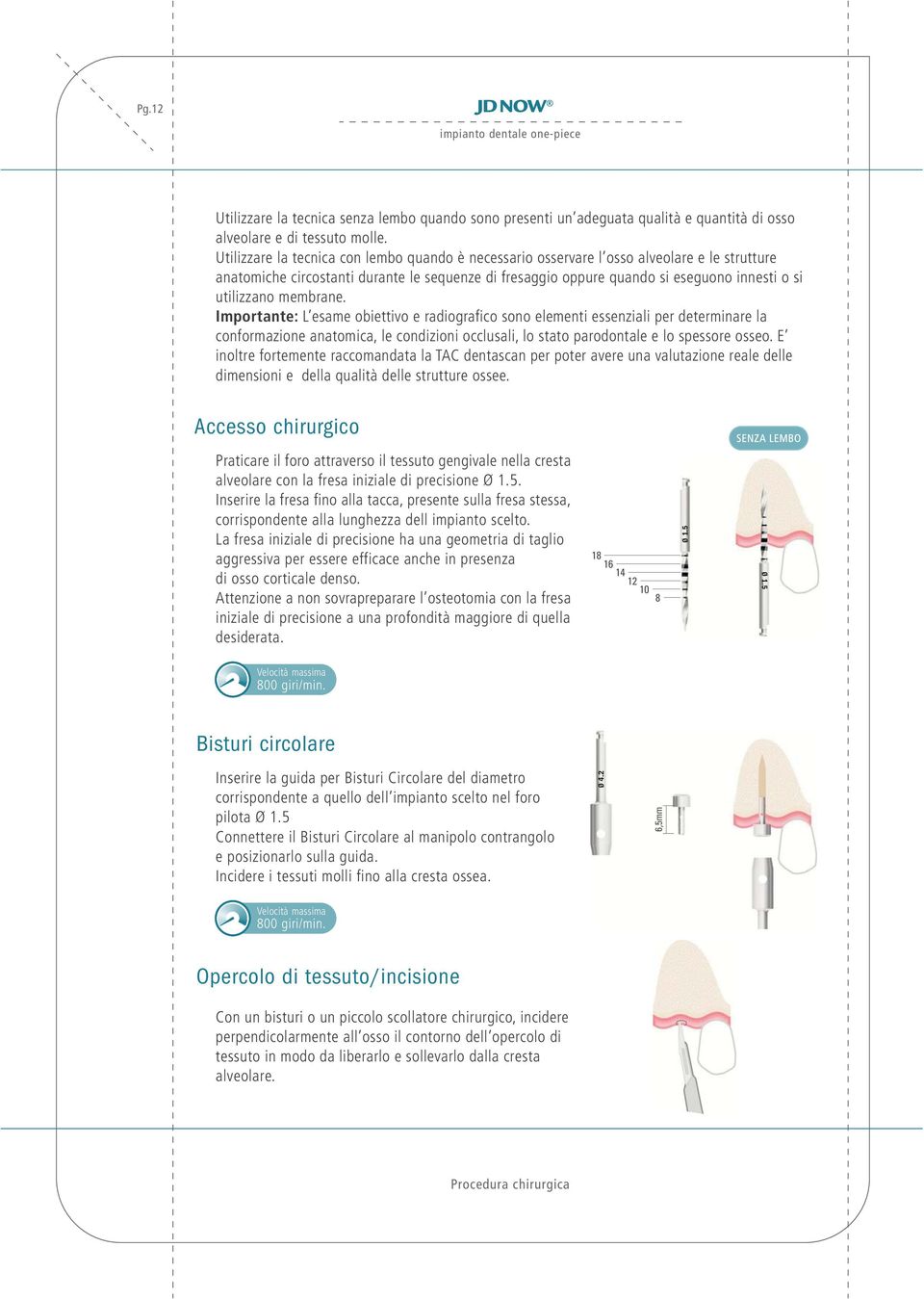 membrane. Importante: L esame obiettivo e radiografico sono elementi essenziali per determinare la conformazione anatomica, le condizioni occlusali, lo stato parodontale e lo spessore osseo.