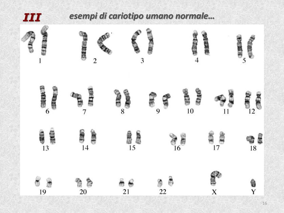 cariotipo