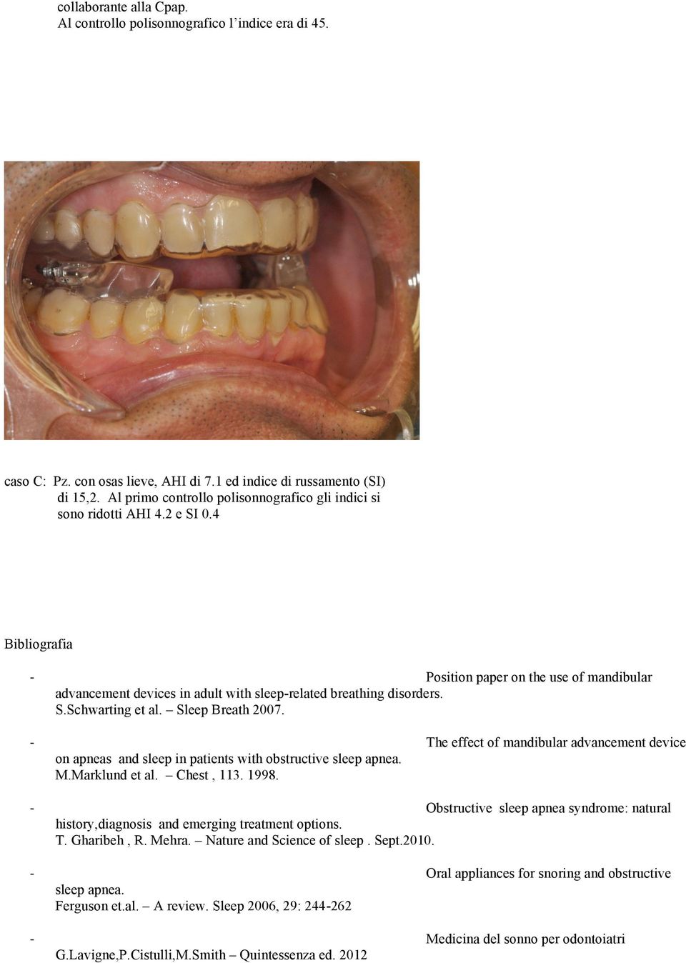 4 Bibliografia Position paper on the use of mandibular advancement devices in adult with sleep-related breathing disorders. S.Schwarting et al. Sleep Breath 2007.