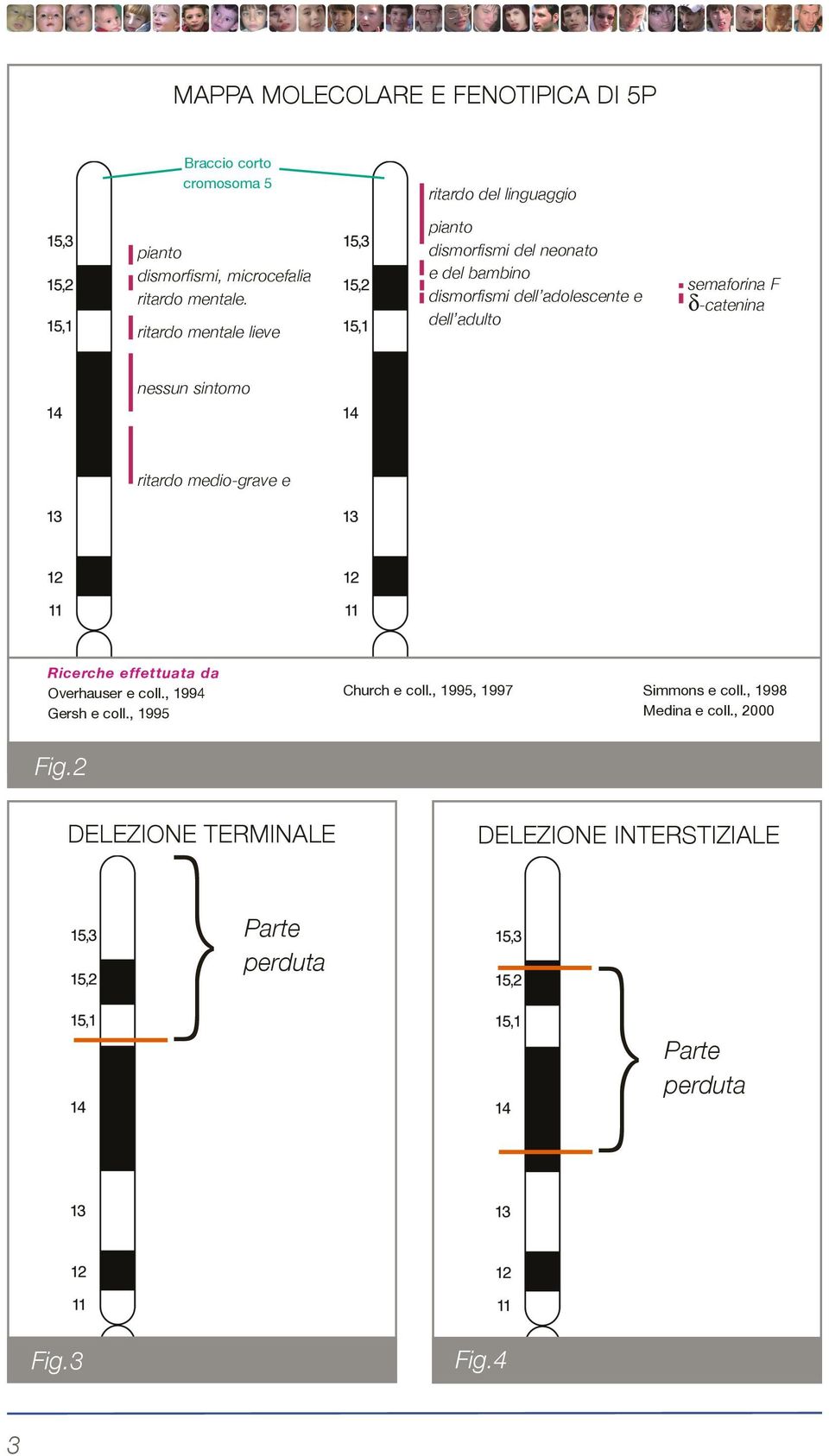 semaforina F δ-catenina nessun sintomo ritardo medio-grave e ricerche effettuata da Overhauser e coll., 1994 Gersh e coll.