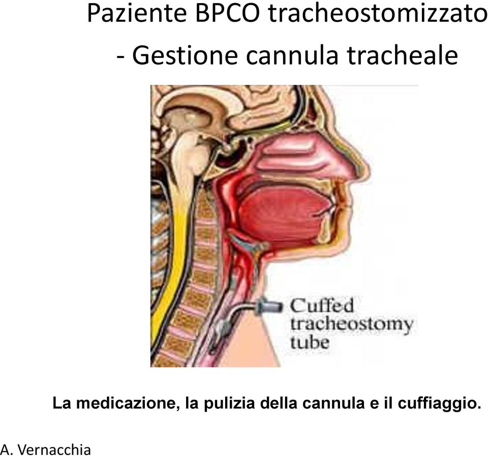 medicazione, la pulizia della