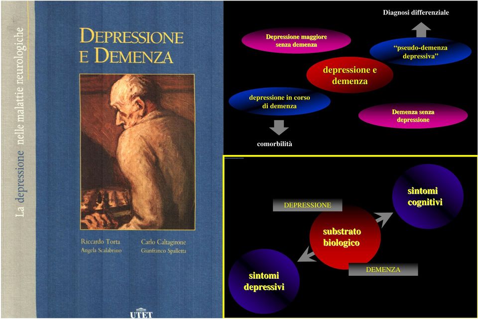 pseudo-demenzademenza depressiva Demenza senza depressione
