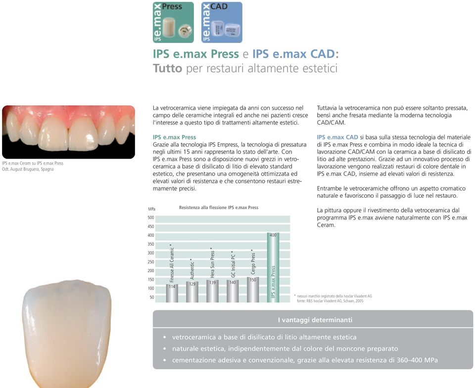 estetici. IPS e.max Press Grazie alla tecnologia IPS Empress, la tecnologia di pressatura negli ultimi 15 anni rappresenta lo stato dell arte. Con IPS e.